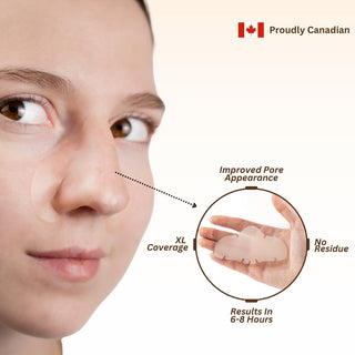 Hydrocolloid Nose Patches