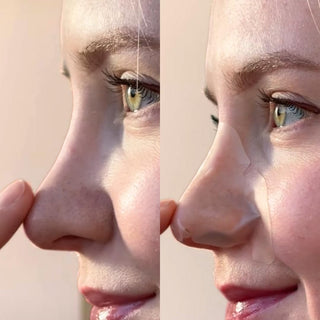 Hydrocolloid Nose Patches