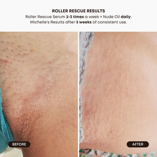 Roller Rescue Soothing Serum with AHA & BHA