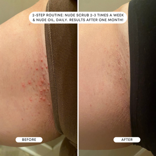 Nude Ingrown Treatment Oil (More Sizes)